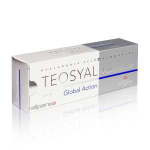 Fillers Teosyal Global Action